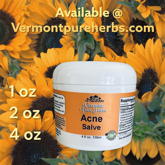 Acne Salve